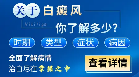 儿童脸上白斑怎么治疗好