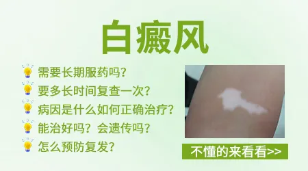 身上有小白点是不是白癜风的前兆