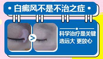 9岁孩子得白癜风能痊愈吗
