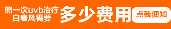 窄谱中波紫外一次的照射费用是多少