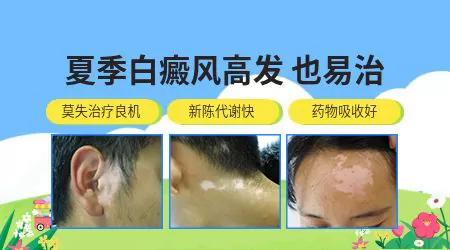 青少年脸上长白斑如何判断是不是白癜风