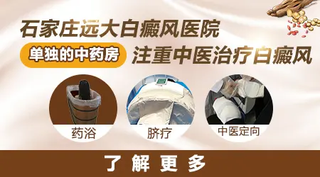 石家庄中医白癜风医院怎么样