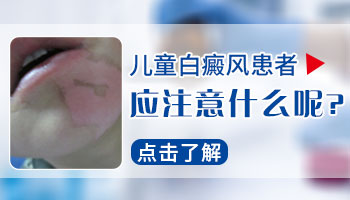 10岁的孩子白癜风接种新冠疫苗用停药吗