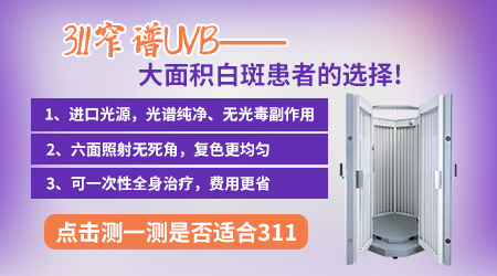 紫外线光疗仪311和308的区别