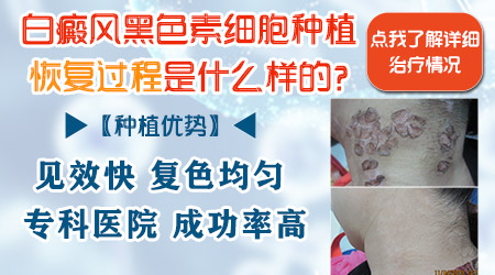 白癜风移植表皮多久会脱落