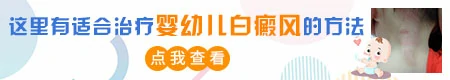 婴幼儿白癜风能手术治疗吗