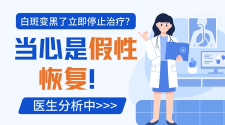 白癜风治好了是不是还要照光
