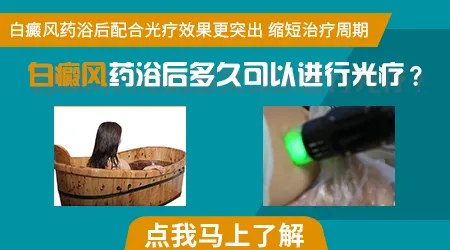 白癜风做窄谱UVB光疗的康复率是多少
