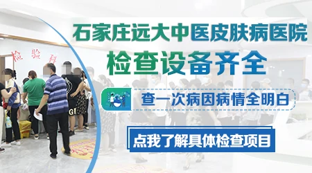 白斑做什么检查能明确病因