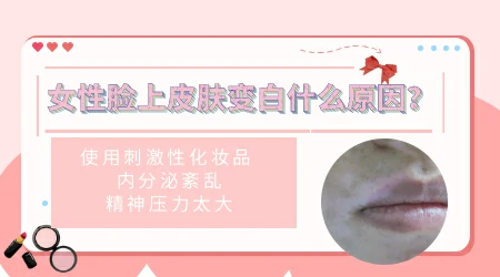 女性左侧脸长好几个白斑怎么回事