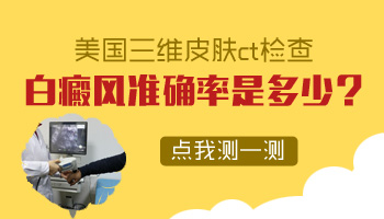 早期白癜风在伍德灯下的图片