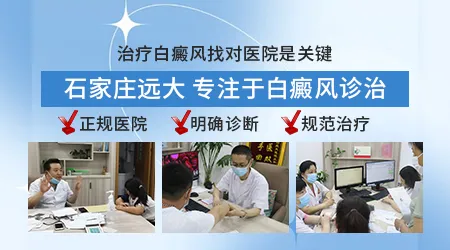 初期白癜风能不能用遮盖