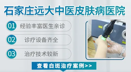 皮肤CT不同医院结果会不一样吗