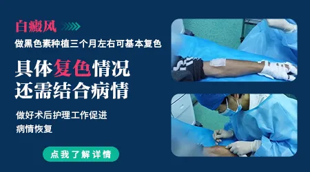 腿上白癜风种植手术要做几次