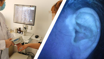 伍德灯检查显示蓝白色荧光是白癜风吗