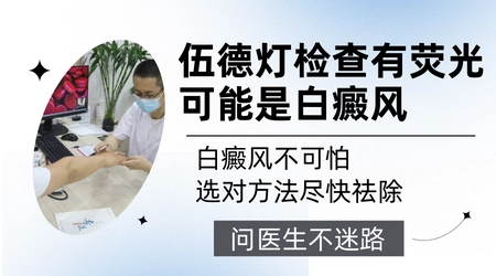 伍德灯照出白斑是不是就确诊白癜风了
