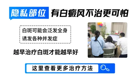 白斑在隐私部位用家用光疗仪可以吗