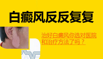 脸上白癜风治好了又变白怎么办
