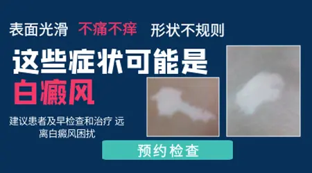 脸上长白块几个月没变大也不痒摸着光滑是什么