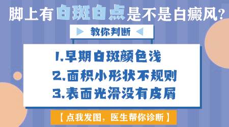 脚上有一块白是白癜风吗 脚上长白癜风的原因有哪些
