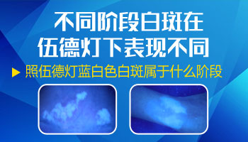 宝宝眼角皮肤发白图片