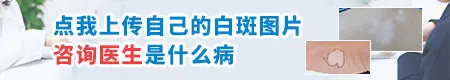 脸上出现白点是什么病的前兆