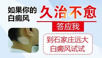 保定哪家医院看白斑病好