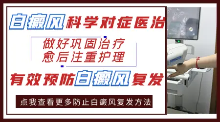 散发型白癜风要如何护理？