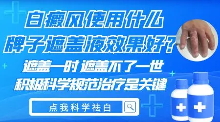 暴露部位的白癜风怎么能遮盖