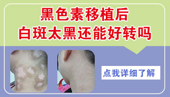 白癜风表皮移植刚拆掉纱布图片