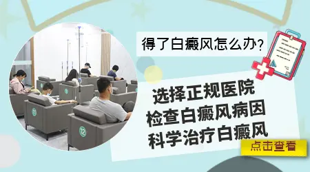 治疗白斑选择中医还是西医更好