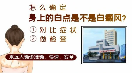 怎么确定身上的白点是不是白癜风
