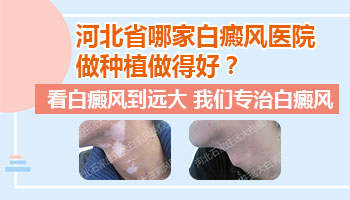 身上白斑边界清晰是什么病