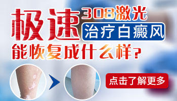 白斑照308激光后理想的样子