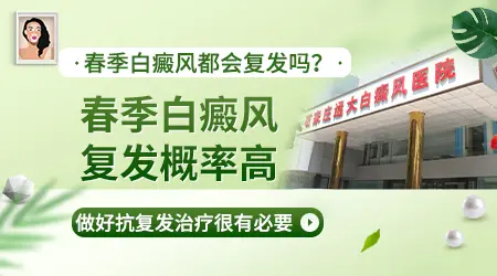 春天得了白癜风一定会扩散吗