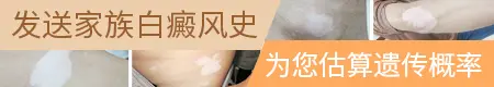 有什么方法能让白癜风不遗传