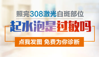 白癜风为什么照了激光会起效小泡泡