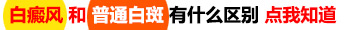 婴儿会得白癜风这种皮肤病吗