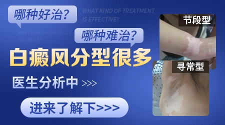 白癜风多吃什么好又不能吃什么