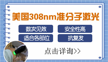 有什么药是促进白癜风黑色素增长的