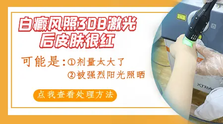白癜风美国308激光治疗后出现皮肤红肿怎么处理