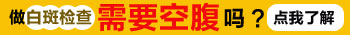 肚子上长小白点不是很多是白癜风吗