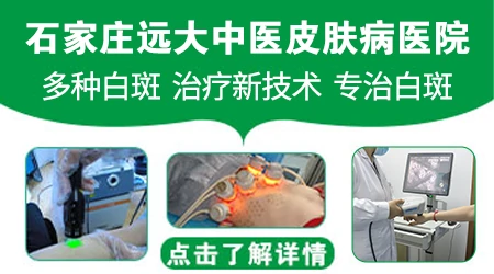 白癜风是艾灸哪些穴位效果好示意图