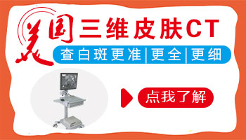 看白斑除了照伍德灯还需要照皮肤ct吗