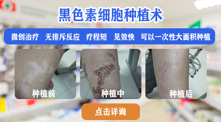 手指关节褶皱处有白斑可以做种植手术吗