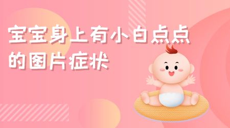 邢台小宝宝白癜风症状是什么样的