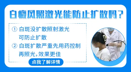 还在扩散期的白癜风能不能光疗
