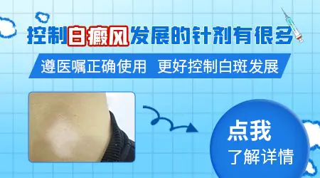 白癜风白斑数量增多的很快怎么控制好