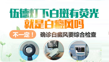 wood灯检查出有荧光一定是白癜风吗