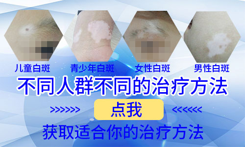 安阳治疗白癜风哪家好 治白斑费用贵不贵